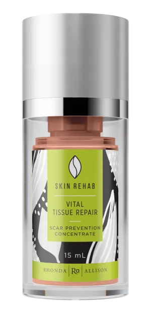 Rhonda Allison MT Vital Tissue Repair